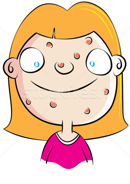 cute white girl with acne problem Stock photo © zkruger