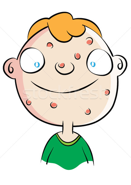 Cute witte jongen acne probleem Stockfoto © zkruger