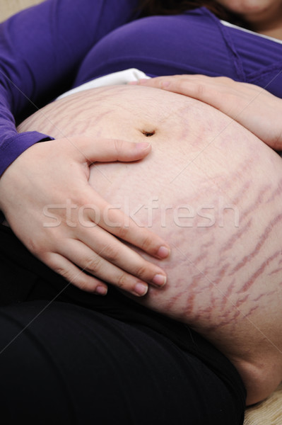 Stock photo: Skin care issue on belly of pregnant woman