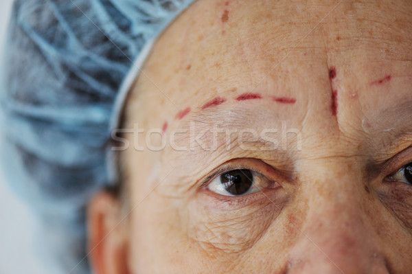 Ready for botox. Senior lady on hospital bed. Stock photo © zurijeta