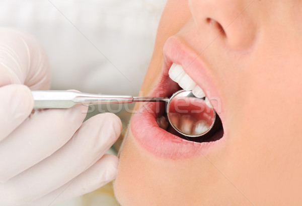 Gesunden Zähne Patienten zahnärztliche Vorbeugung Stock foto © zurijeta
