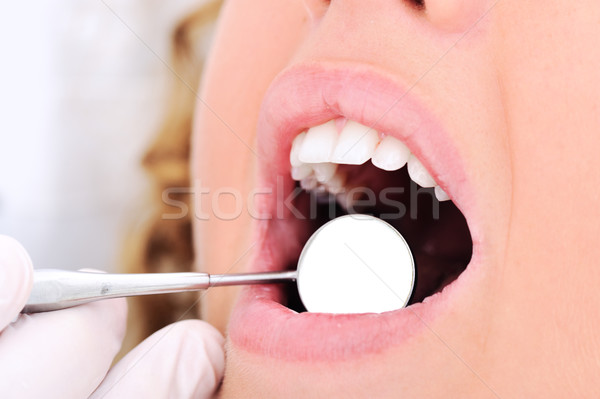 Dentist's teeth checkup, series of related photos Stock photo © zurijeta