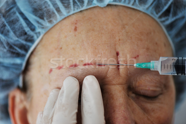 Senior femeie botox-ul injectie spital modă femeie Imagine de stoc © zurijeta