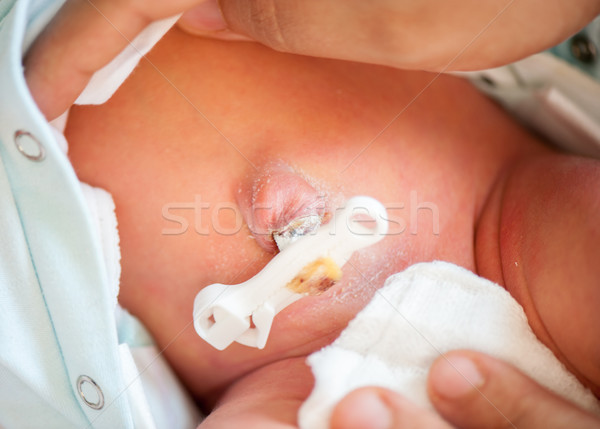 Newborn baby belly-button Stock photo © zurijeta