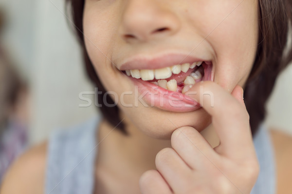 Happy little kid with tooth down Stock photo © zurijeta