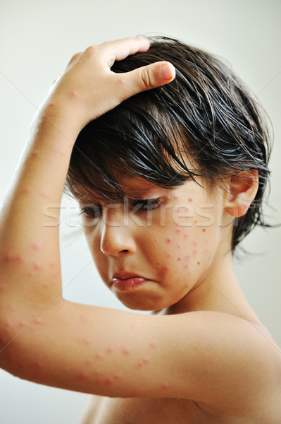 Piele boala medical copil pui băiat Imagine de stoc © zurijeta