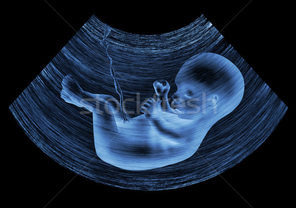 超聲 嬰兒 圖像 母親 子宮 孩子 商業照片 © zven0