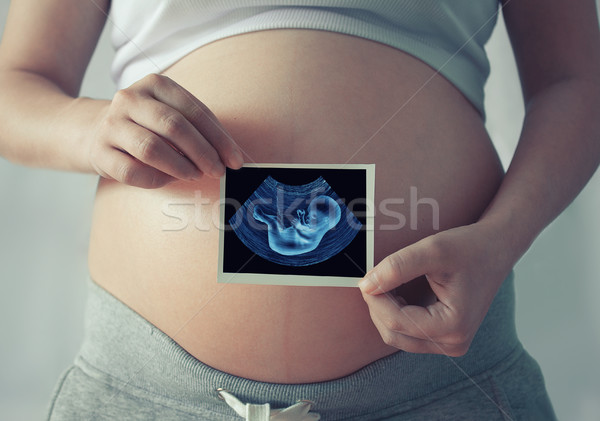Mujer embarazada ultrasonido escanear vientre mujer Foto stock © zven0