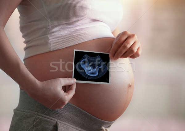 Hamile kadın ultrason taramak ışık kadın Stok fotoğraf © zven0